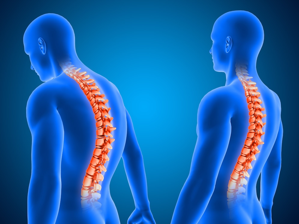 How Correcting Your Posture Can Repair Your Back - Physiotherapy,  Chiropractor and Custom Orthotics